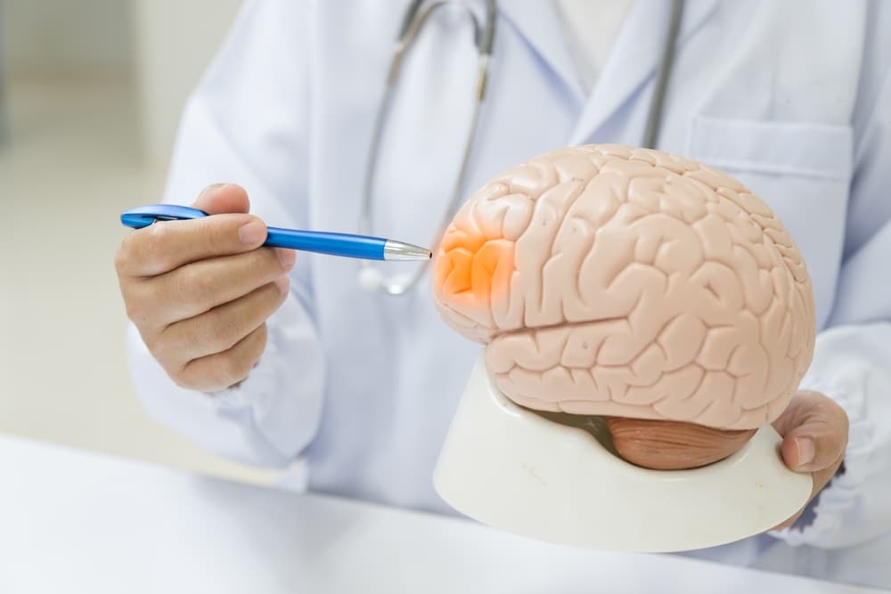 A doctor pointing at a specific area on a brain model, indicating brain injury location.