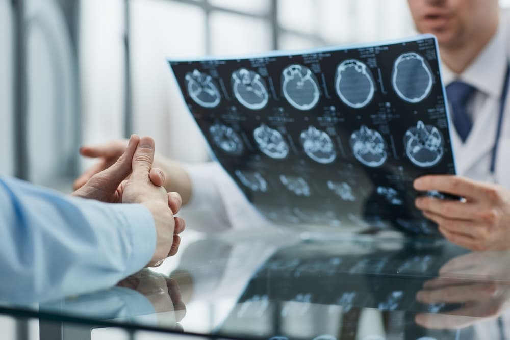 A doctor showing a patient brain scan images, discussing the results and potential brain injuries.